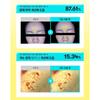 VT COSMETICS PDRN Tone On Line (5 продуктов / Доступен полный набор)