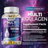 Pslalae Collagen Softgels, a natural hydrolyzed collagen peptide supplement, support hair, skin, nail, and joint health.