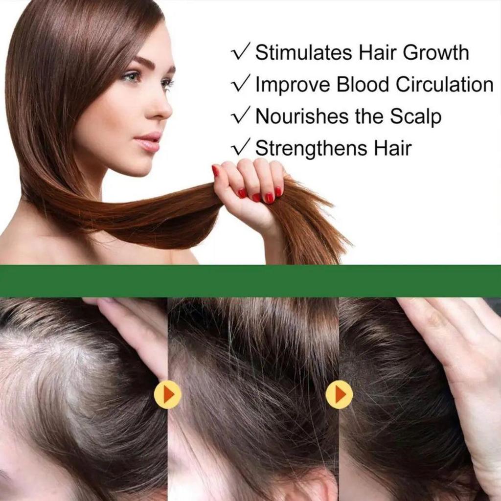 Hair Growth Product, Rosemary Growing Hair Essential Oil Beauty Hair Care, Prevent Hair Loss