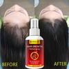 Hair Growth Serum Spray Fast Hair Growth Liquid Treatment Scalp Hair Follicle Anti Hair Loss Natural Beauty Health Hair Care