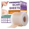 Silicone Scar Sheets,Silicone Scar Tape,Scar Tape For Surgical Scars,Silicone Scar Removal Strips For Surgical,C-Section,Tummy Tuck,Keloid