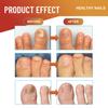 32 Pcs/Bag Toe Care Patches Safe Gentle Nail Fungus Relief Improve Nail Appearance Strengthen Nails Night Fungus Nail Patches