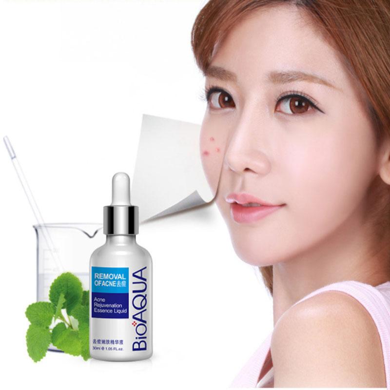 30 мл отбеливающая и анти-акне эссенция для лица, увлажняющая и жирная сыворотка для лица