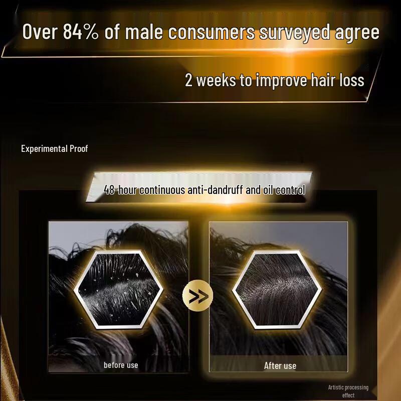 CLEAR Men Anti-Hair Loss & Strengthening Shampoo