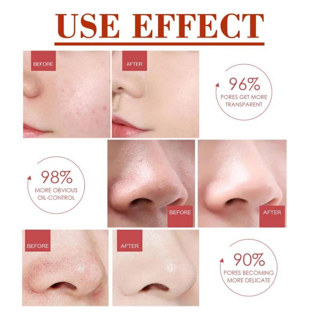 Vitamin C Retinol Firming Serum, Firming Lifting Essence, Softens Skin, Improves Elasticity,  Smoothes Wrinkles, Skin Care Face Serum For Women