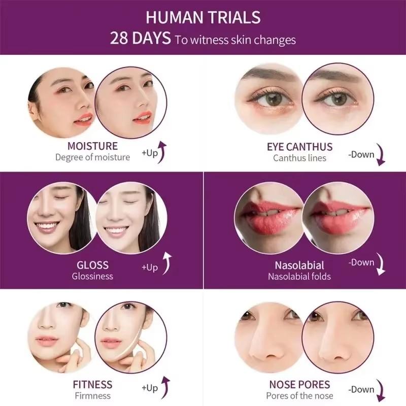 Аппарат для подтяжки лица с горячей и холодной терапией EMS, устройство для подтяжки кожи, массажер для лица, шеи и тела, подбородка, V-образная линия для кожи, против морщин