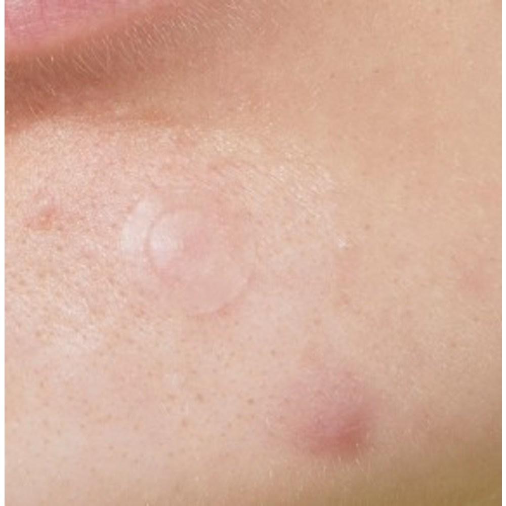 Пластырь для проблемной кожи Idewcare Time Out Blemish Patch Plus, 36 шт., 1 шт.