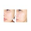 Dr.Orga Мазь Forlab Centellascar(Бэзил) 15g