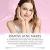 Facial Acne Cream, Repairing Facial Acne, Close The Mouth To Nourish Skin Tender And Smooth Skin Care Cream