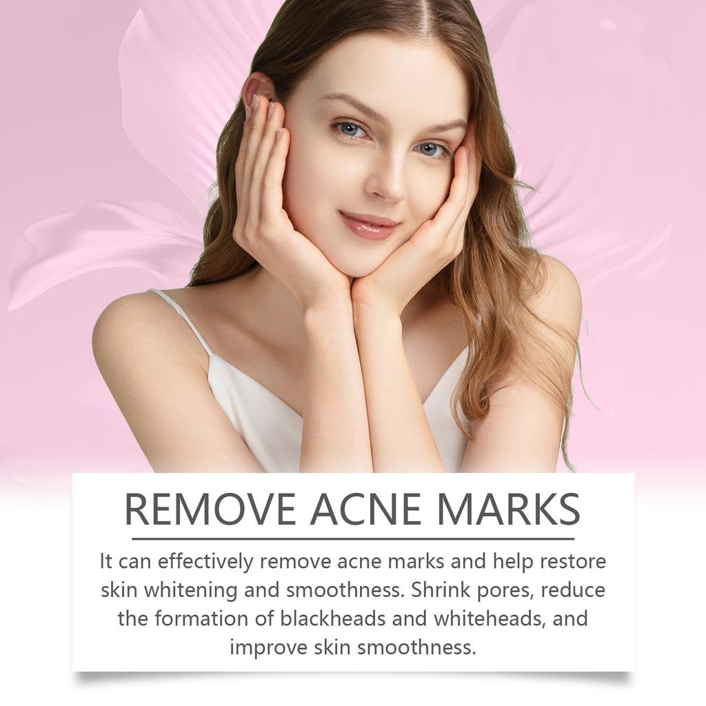 Facial Acne Cream, Repairing Facial Acne, Close The Mouth To Nourish Skin Tender And Smooth Skin Care Cream