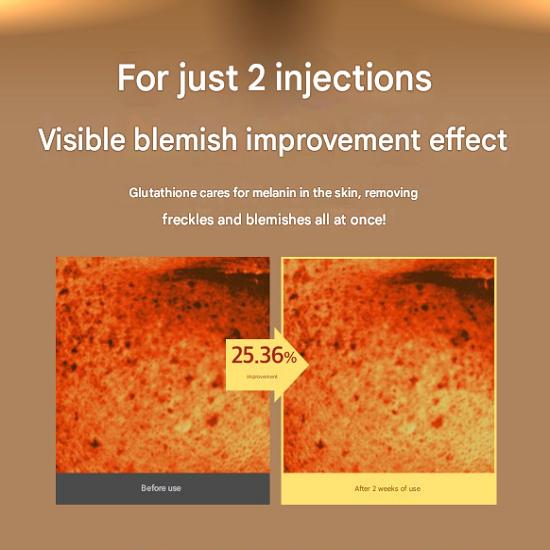 Крем от веснушек с глутатионом, пигментные пятна, веснушки, увлажнение, регенерация, увлажняющий, отбеливающий крем, 50 мл, 1 шт.