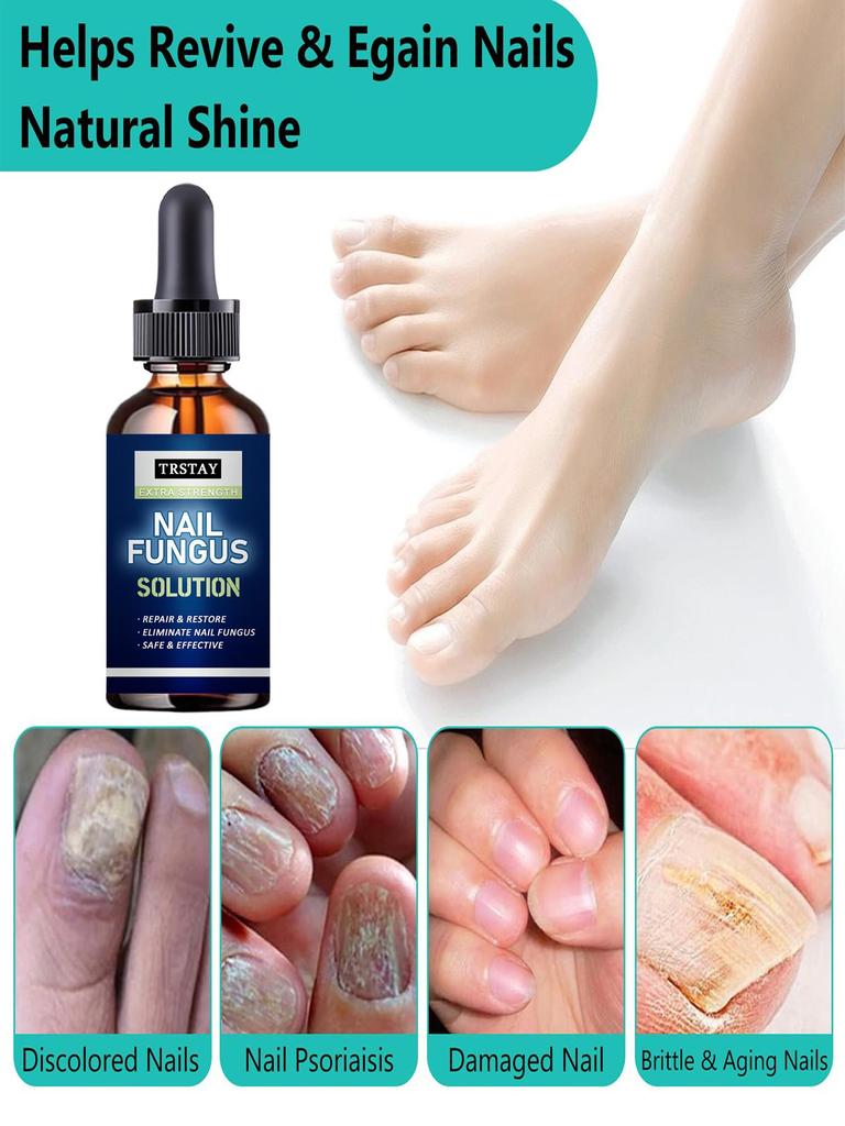 5 мл/15 мл/30 мл/50 мл/Crazylife Hand And Foot Nail Onycho Repair Nail Onychomycetant для утолщения ногтей, подавитель