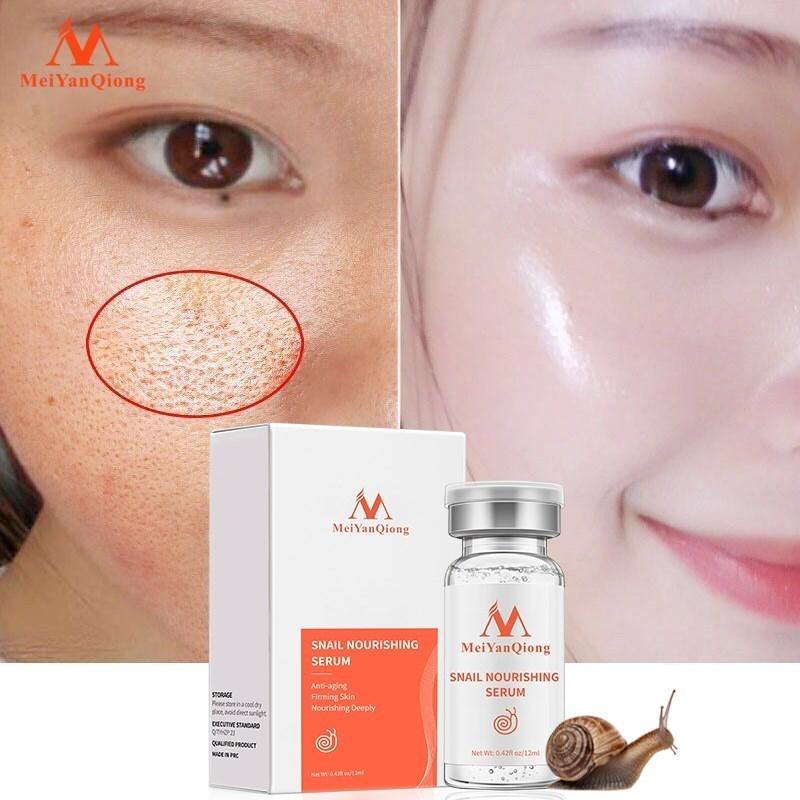 High Quality Snail100% Essence Hyaluronic Acid Liquid Whitening Spot Essence Shrink Pores Ampoule Anti-acne Regenerative Essence