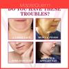 Facelift Firming Cream With Gentle Lifting For Mature Skin Care 20g