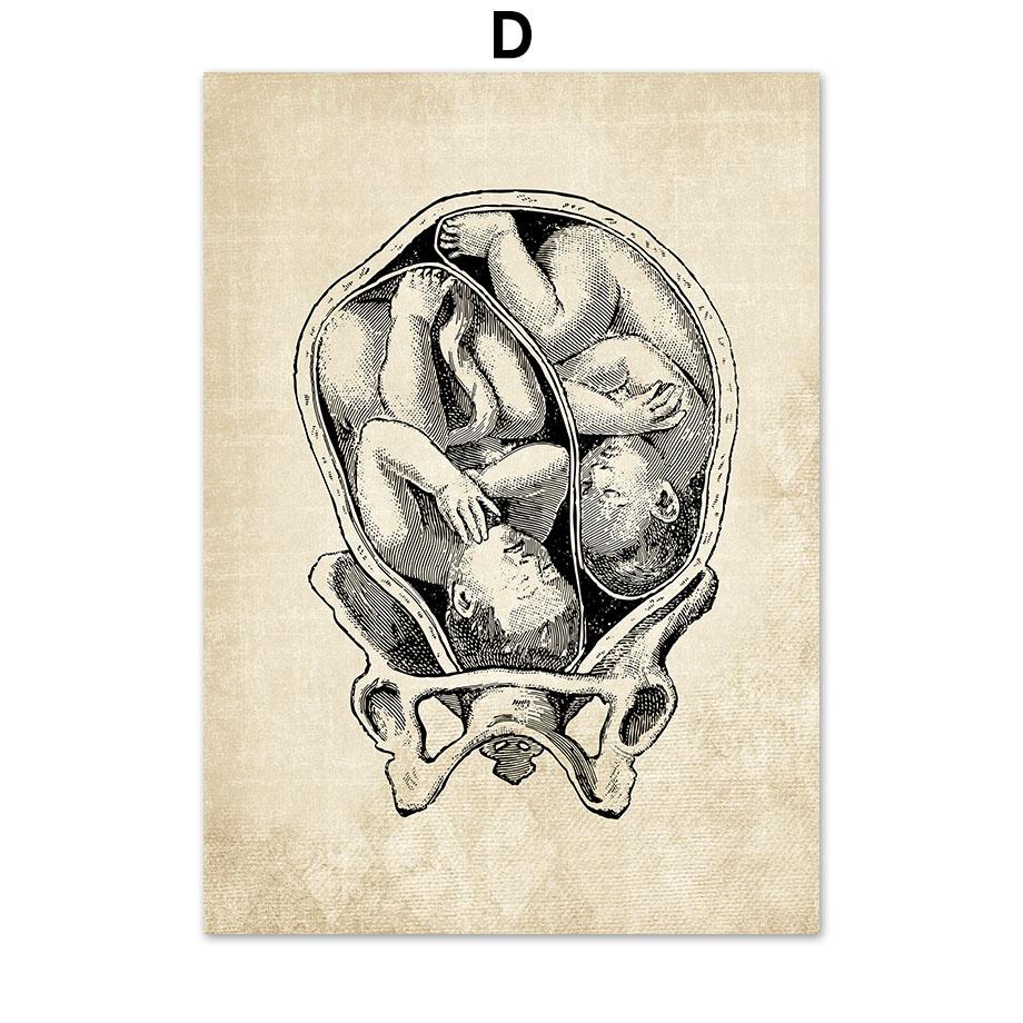 Постеры на скандинавскую тему и принты, настенная живопись на холсте, Анатомия, скелет, винтажные настенные панно для больницы, доктора, офисного декора
