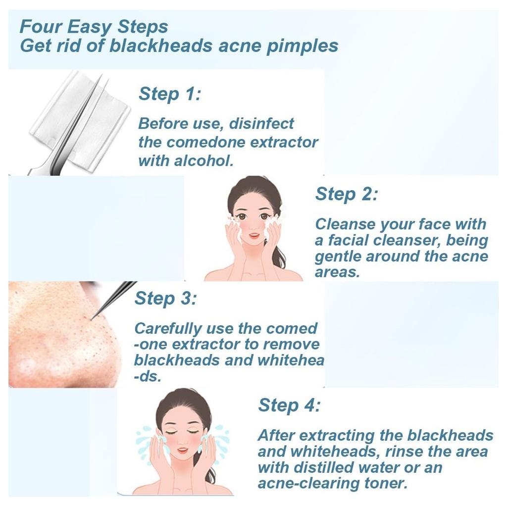 Набор инструментов для удаления черных точек из нержавеющей стали, средство для удаления черных точек класса Blackhead Extraction Blackhead / Whiteheads / MI2 / Pimples Remover For Face