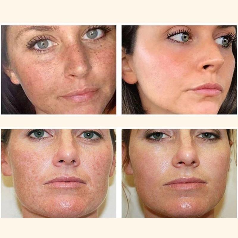 Skin Whitening Cream Moisturizing and Anti-freckle Cream Repairs The Skin and Facial Skin Care Products