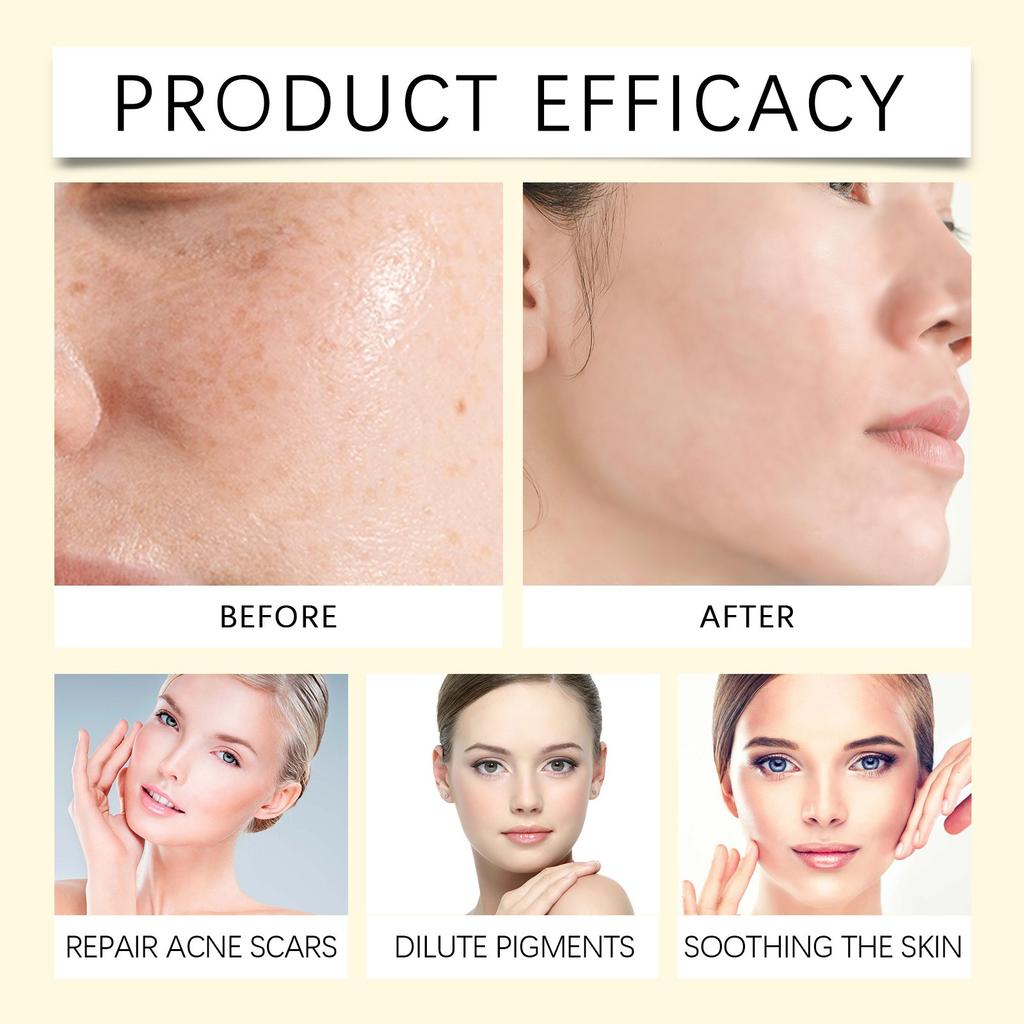 Крем для коррекции меланина, уменьшает тусклость и улучшает текстуру нежной кожи, отбеливающий крем, 100 г(1шт