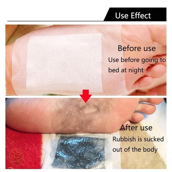 Теплые детокс-патчи для ног, подушечки для тела, токсины, уход за ногами, очищающий травяной клей