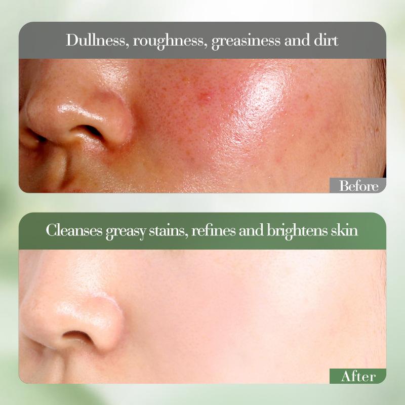 Киви VC отбеливающий аминокислотный мягкий очищающий крем для контроля жирности кожи, удаления прыщей, растительная эссенция крем для лица уход за кожей лица