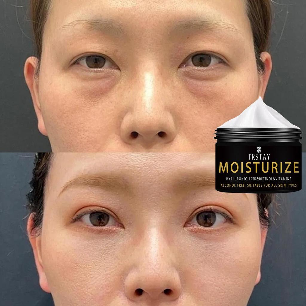 Caffeine Eye Cream for Anti Aging, Dark Circles Bags Puffiness Great Under Eye Skin + Face Tightening