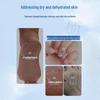 Baiyunshan Hand & Foot Dry Skin & Crack Repair