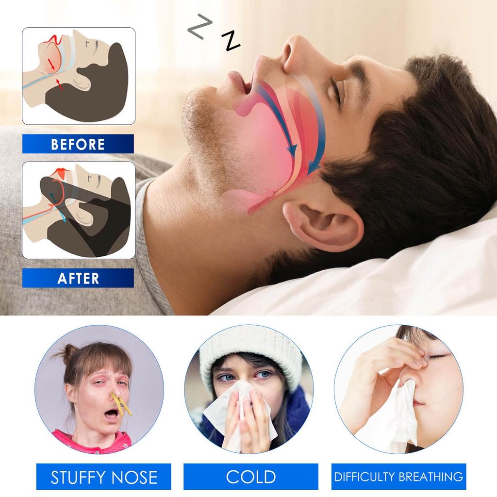 Anti-snoring Spray Herbal Sleep Anti-snoring Spray Men And Women Anti-snoring Spray Nose And Mouth Herbal Anti-snoring Spray Snoring Solution(30ML)