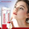 Freckles Cream, Whitening Cream Facial Pigmentation Removal Cream, Moisturizing To Remove Melasma And Dark Spots On The Face