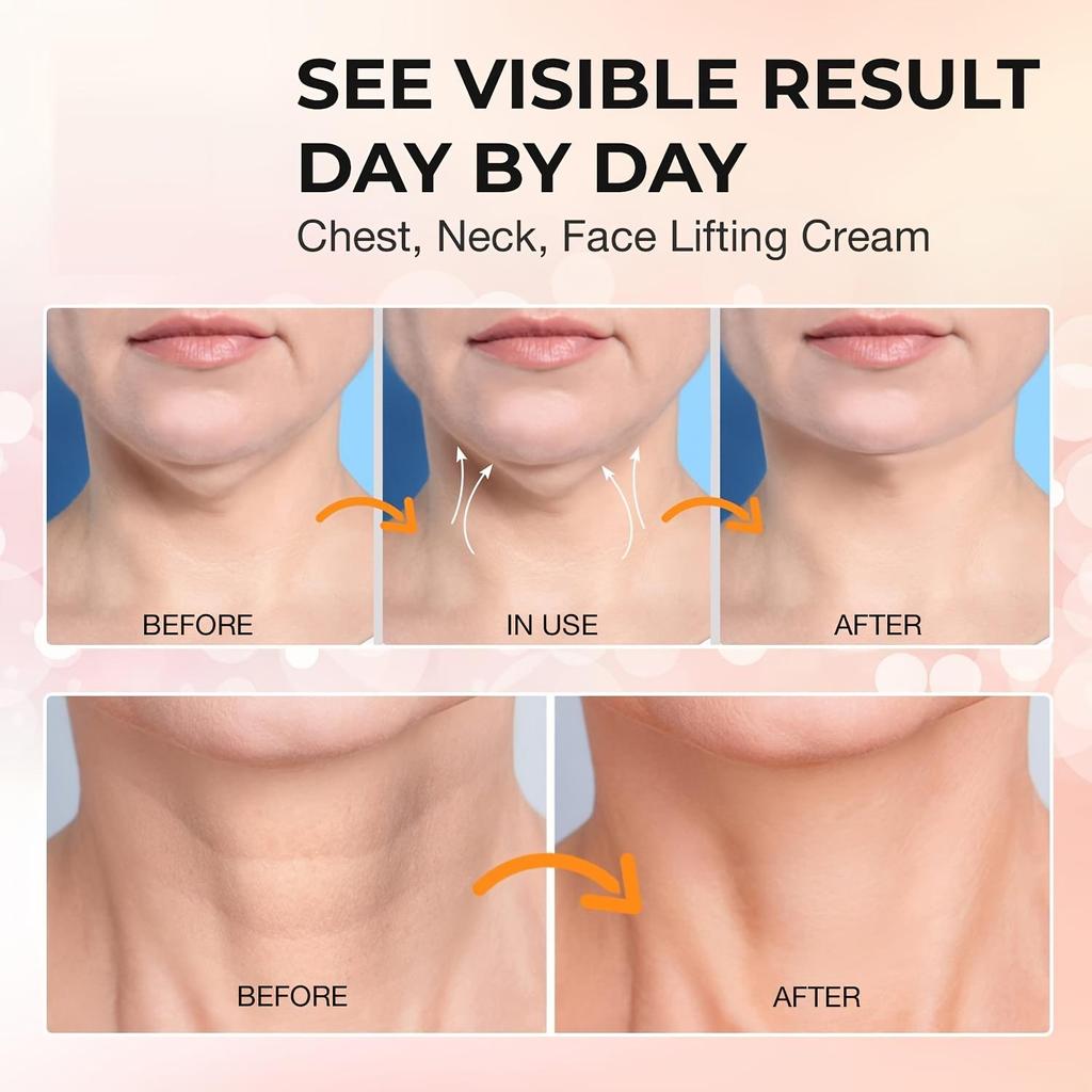 Укрепляющий крем для шеи - увлажняющий крем для лица, гиалуроновая кислота - уменьшение двойного подбородка, укрепляющий увлажняющий крем