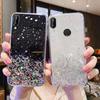 Huawei Nova 12 Y70 7i 8i 9 SE Honor X9B 70 X7 X8 X6 8A 8X 9X 90 10 20 50 200 Lite P20 P30 P40 uchun moda yulduzli silikon g'ilof