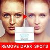 Newest Dark Spots Corrector Cream Whitening Facial Cream Repair Fade Freckles Remove Dark Spots Melanin Remover Brightening Face Cream
