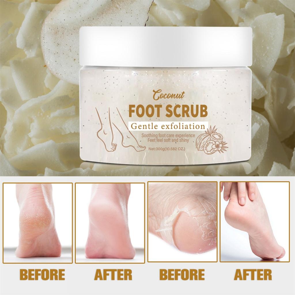 Удалить отшелушивающий скраб для ног Пилинг кожи Мозоли Красота Уход за ногами