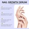Сыворотка для роста ногтей, уход за ногтями от грибка, ручка для восстановления здорового вида ногтей, обесцвеченных или поврежденных грибком ногтей, 3 мл