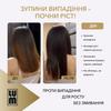 Набор LUM "90-дневный курс": активация фолликулов и формирование плотности"
