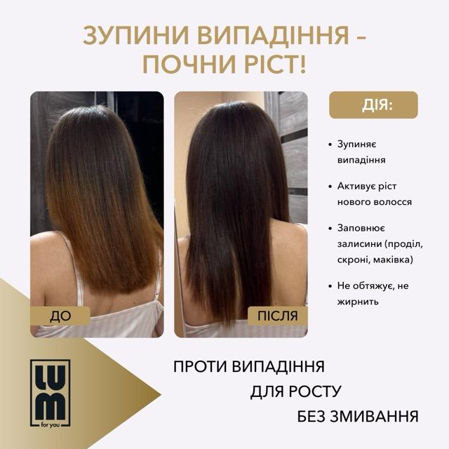 Набор LUM "90-дневный курс": активация фолликулов и формирование плотности"
