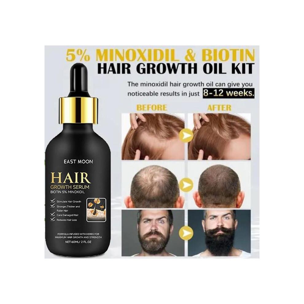 5 % Minoxidil-Haarwuchsserum-Set, Minoxidil- und Biotin-Haarwuchsbehandlung für Männer und Frauen