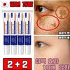 1+1/2+2 Facial Blemish Whitening Cream Freckle and Age Spot Removal Cream Pigmentation Melatoning Pigmentation Whitening Free Gift, 20g, 4 Pieces
