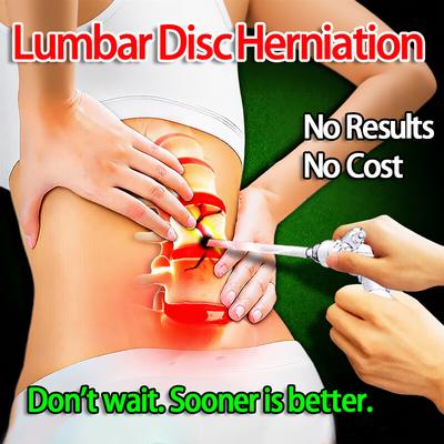 Специализируясь на грыжах поясничного диска, точное облегчение сдавленной невралгии
