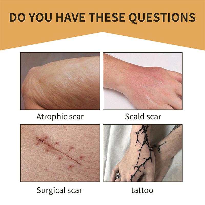 Невидимый консилер для кожи, наклейка, дышащая татуировка, шрам, водонепроницаемый чехол