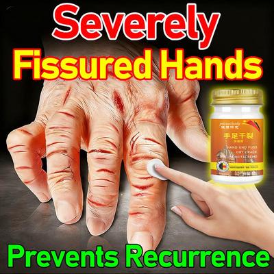 Мазь для заживления при грибковой инфекции, шелушении и трещинах на руках и ногах