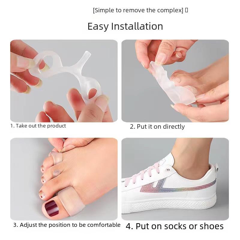 Разделитель и корректор пальцев ног: Протектор вальгусной деформации для женщин