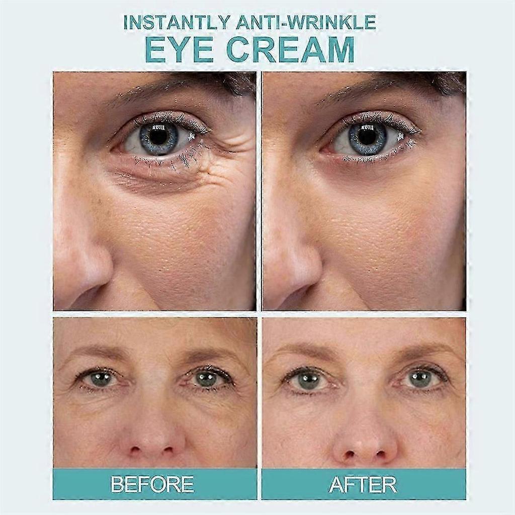 1/2/3/4Pcs Instantly Eyes Dark Circle Cream 5pcs/set Anti-Aging Under Eye Cream Remove Eye Bags Puffiness Lift Plump Firm Tighten Eyes Skin