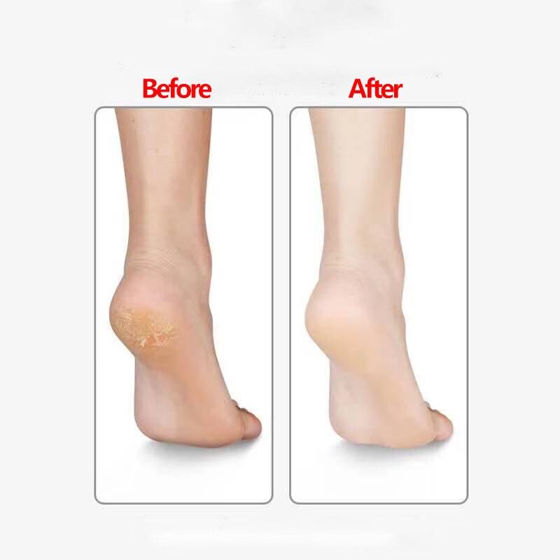 Пилочка для ног Жесткая омертвевшая кожа Средство для удаления мозолей Нано-стекло Инструменты для педикюра Скруббер для ног Профессиональный шлифовальный уход за кожей ног Pedicura