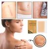 6Pcs/Box Wide Application Skin Scar Sticker Waterproof Practical Acne Trauma Burn Removal Sheet