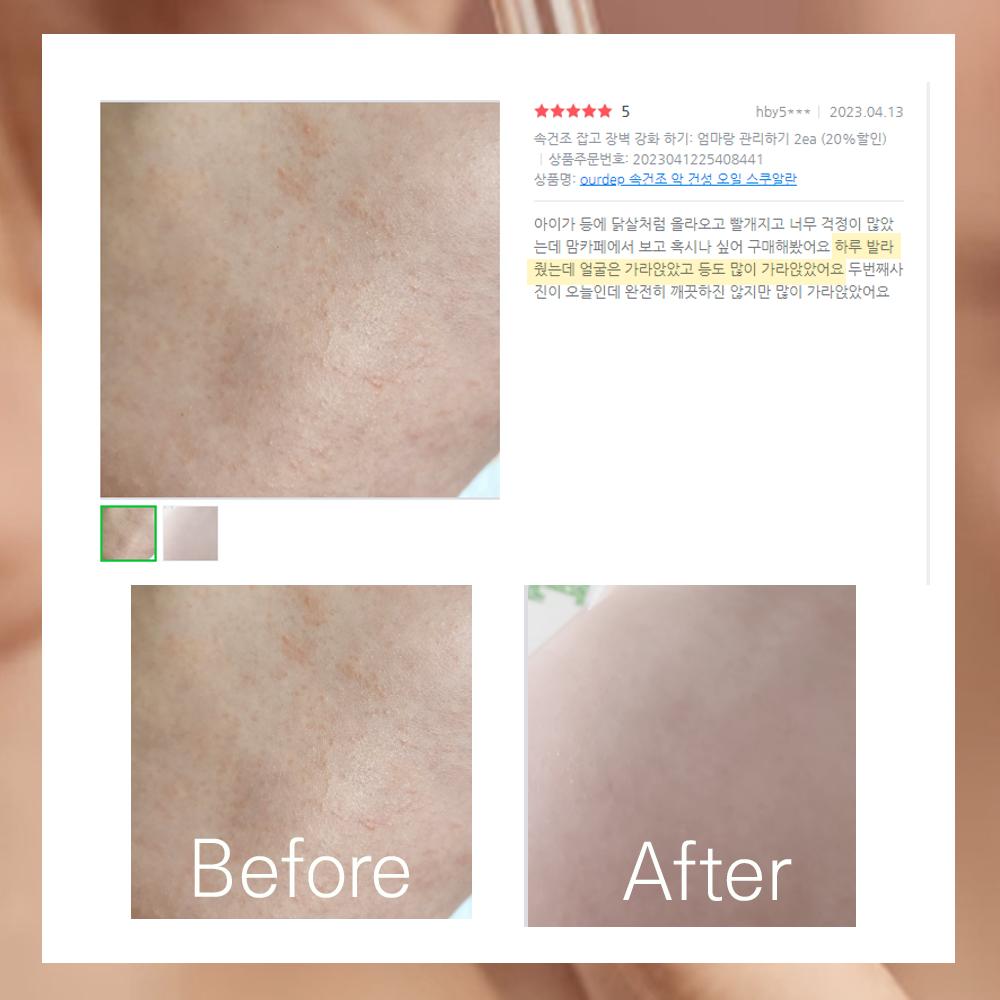 Масло сквалан от экземы для очень сухой кожи, 30 мл, 2 шт.