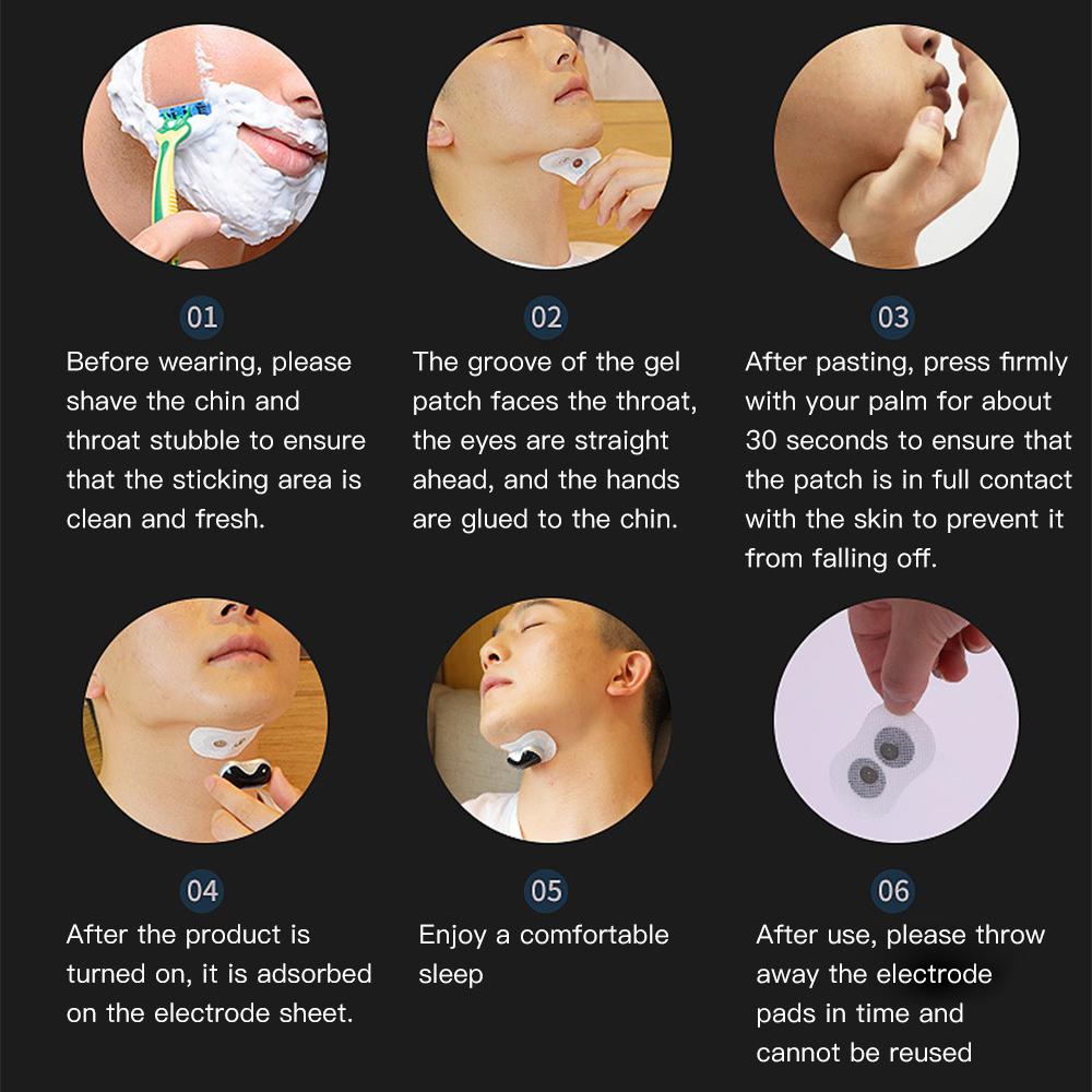 Электрический интеллектуальный фиксатор храпа EMS Импульсное устройство против храпа Эффективное решение Средство от храпа при апноэ во сне Снижение шума Анти-Ронко