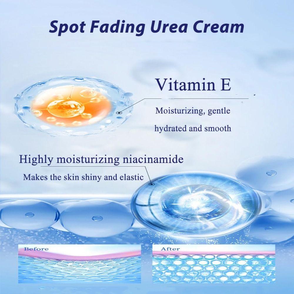 Отбеливающий крем для лица Удаление веснушек Увлажнитель для лица Крем для обесцвечивания кожи с мочевиной Уход за кожей