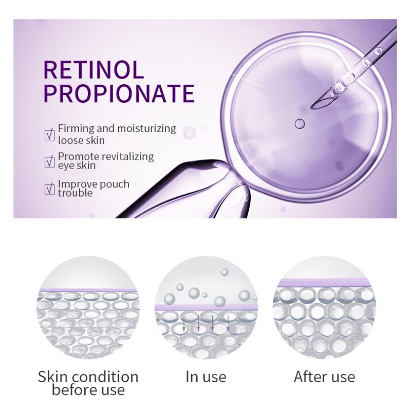 Крем для глаз с шариками-роллерами, ходячие бусины, массаж, увлажнение и увлажнение глаз, питательная эссенция для глаз, осветляющие мешки под глазами