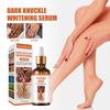 50ml Skin Beauty De-Tanning Serum Brighten Skin Tone Knee & Ankle Corner De-Marker Moisturizing Serum