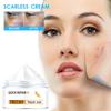 Skin Wound Cream Burning Fading Cream Surgery Repair Scar Skin Care Skin Whitening Cream